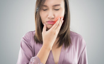 How Long Is Wisdom Teeth Recovery Time
